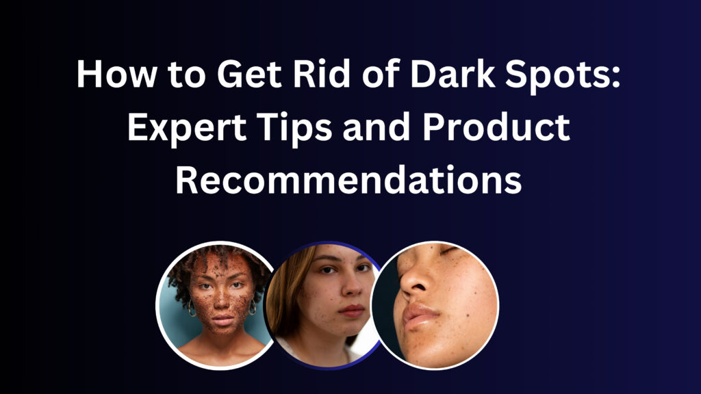 How to Get Rid of Dark Spots: Expert Tips and Product Recommendations